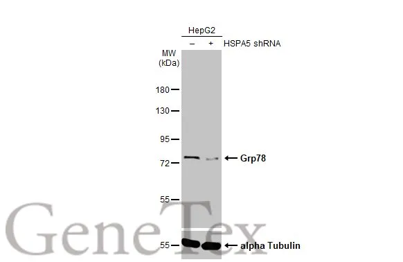 Non-transfected (–) and transfected (+) HepG2 whole cell extracts (5 μg) were separated by 7.5% SDS-PAGE, and the membrane was blotted with Grp78 antibody [HL1815] (GTX637540) diluted at 1:100000. The HRP-conjugated anti-rabbit IgG antibody (GTX213110-01) was used to detect the primary antibody.
