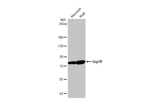 Various whole cell extracts (30 μg) were separated by 7.5% SDS-PAGE, and the membrane was blotted with Grp78 antibody [HL1815] (GTX637540) diluted at 1:10000. The HRP-conjugated anti-rabbit IgG antibody (GTX213110-01) was used to detect the primary antibody.