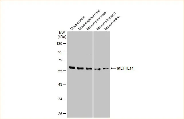 Various mouse tissue extracts (50 μg) were separated by 10% SDS-PAGE, and the membrane was blotted with METTL14 antibody [HL1816] (GTX637541) diluted at 1:1000. The HRP-conjugated anti-rabbit IgG antibody (GTX213110-01) was used to detect the primary antibody.