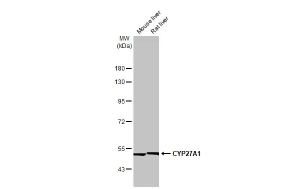 Various tissue extracts (50 μg) were separated by 7.5% SDS-PAGE, and the membrane was blotted with CYP27A1 antibody [HL1820] (GTX637545) diluted at 1:1000. The HRP-conjugated anti-rabbit IgG antibody (GTX213110-01) was used to detect the primary antibody.