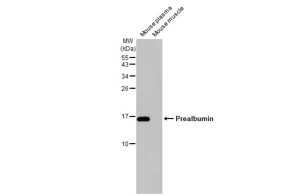 Various tissue extracts (50 μg) were separated by 15% SDS-PAGE, and the membrane was blotted with Prealbumin antibody [HL1823] (GTX637548) diluted at 1:5000. The HRP-conjugated anti-rabbit IgG antibody (GTX213110-01) was used to detect the primary antibody.