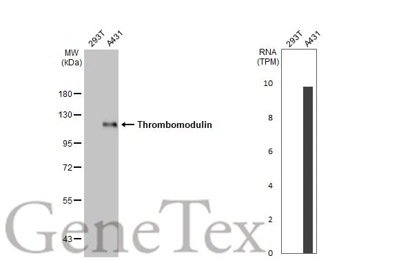 Various whole cell extracts (30 μg) were separated by 7.5% SDS-PAGE, and the membrane was blotted with Thrombomodulin antibody [HL1825] (GTX637550) diluted at 1:1000. The HRP-conjugated anti-rabbit IgG antibody (GTX213110-01) was used to detect the primary antibody. Corresponding RNA expression data for the same cell lines are based on Human Protein Atlas program.