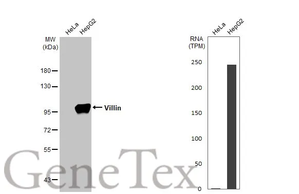 Various whole cell extracts (30 μg) were separated by 7.5% SDS-PAGE, and the membrane was blotted with Villin antibody [HL1830] (GTX637555) diluted at 1:4000. The HRP-conjugated anti-rabbit IgG antibody (GTX213110-01) was used to detect the primary antibody. Corresponding RNA expression data for the same cell lines are based on Human Protein Atlas program.