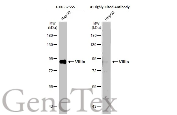 Whole cell extract (30 μg) was separated by 7.5% SDS-PAGE, and the membranes were blotted with Villin antibody [HL1830] (GTX637555) diluted at 1:4000 and competitor's antibody (#Highly competitor antibody) diluted at 1:1000. The HRP-conjugated anti-rabbit IgG antibody (GTX213110-01) was used to detect the primary antibody. *The competitor is not affiliated with GeneTex and does not endorse this product.