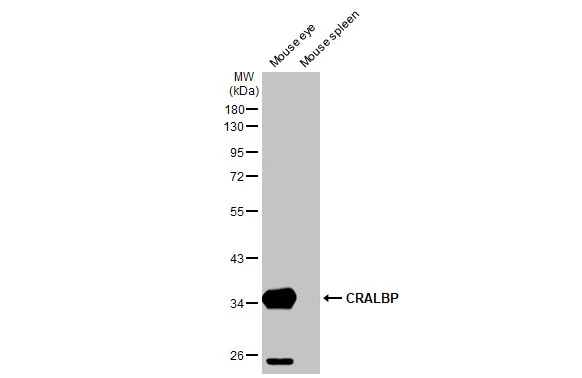 Various tissue extracts (50 μg) were separated by 10% SDS-PAGE, and the membrane was blotted with CRALBP antibody [HL1833] (GTX637558) diluted at 1:1000. The HRP-conjugated anti-rabbit IgG antibody (GTX213110-01) was used to detect the primary antibody.