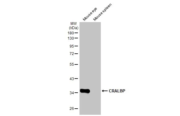Various tissue extracts (50 μg) were separated by 10% SDS-PAGE, and the membrane was blotted with CRALBP antibody [HL1834] (GTX637559) diluted at 1:1000. The HRP-conjugated anti-rabbit IgG antibody (GTX213110-01) was used to detect the primary antibody.