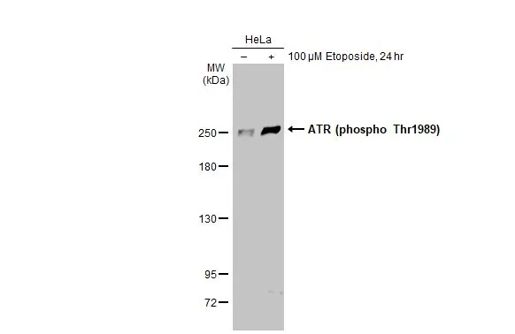 Untreated (–) and treated (+) HeLa whole cell extract (30 μg) were separated by 5% SDS-PAGE, and the membrane was blotted with ATR (phospho Thr1989) antibody [HL1835] (GTX637560) diluted at 1:1000. The HRP-conjugated anti-rabbit IgG antibody (GTX213110-01) was used to detect the primary antibody.