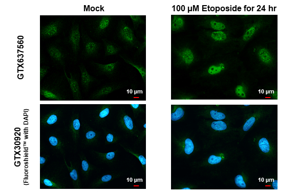 ATR (phospho Thr1989) antibody [HL1835] detects ATR (phospho Thr1989) protein at nucleus by immunofluorescent analysis. Sample: Mock and treated HeLa cells were fixed in 4% paraformaldehyde at RT for 15 min. Green: ATR (phospho Thr1989) stained by ATR (phospho Thr1989) antibody [HL1835] (GTX637560) diluted at 1:500. Blue: Fluoroshield with DAPI (GTX30920).