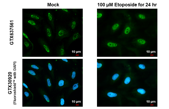 ATR (phospho Thr1989) antibody [HL1836] detects ATR (phospho Thr1989) protein at cytoplasm and nucleus by immunofluorescent analysis. Sample: Mock and treated HeLa cells were fixed in 4% paraformaldehyde at RT for 15 min. Green: ATR (phospho Thr1989) stained by ATR (phospho Thr1989) antibody [HL1836] (GTX637561) diluted at 1:500. Blue: Fluoroshield with DAPI (GTX30920).