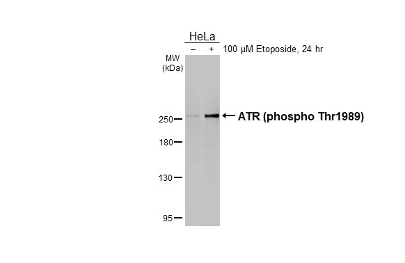 Untreated (–) and treated (+) HeLa whole cell extracts (30 μg) were separated by 5% SDS-PAGE, and the membrane was blotted with ATR (phospho Thr1989) antibody [HL1836] (GTX637561) diluted at 1:1000. The HRP-conjugated anti-rabbit IgG antibody (GTX213110-01) was used to detect the primary antibody.