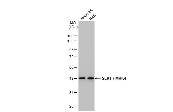 Various whole cell extracts (30 μg) were separated by 10% SDS-PAGE, and the membrane was blotted with SEK1 / MKK4 antibody [HL1839] (GTX637564) diluted at 1:1000. The HRP-conjated anti-rabbit IgG antibody (GTX213110-01) was used to detect the primary antibody.