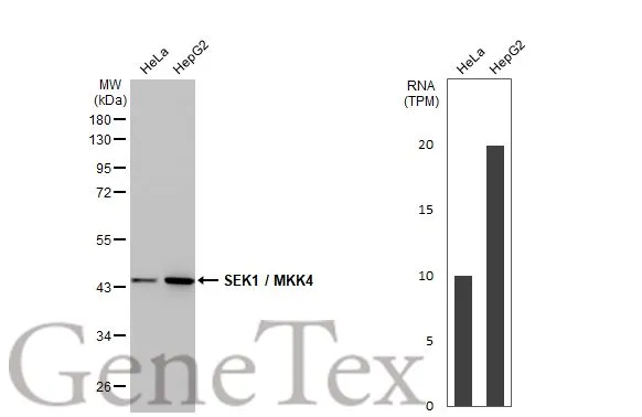 Various whole cell extracts (30 μg) were separated by 10% SDS-PAGE, and the membrane was blotted with SEK1 / MKK4 antibody [HL1839] (GTX637564) diluted at 1:1000. The HRP-conjated anti-rabbit IgG antibody (GTX213110-01) was used to detect the primary antibody. Corresponding RNA expression data for the same cell lines are based on Human Protein Atlas program.