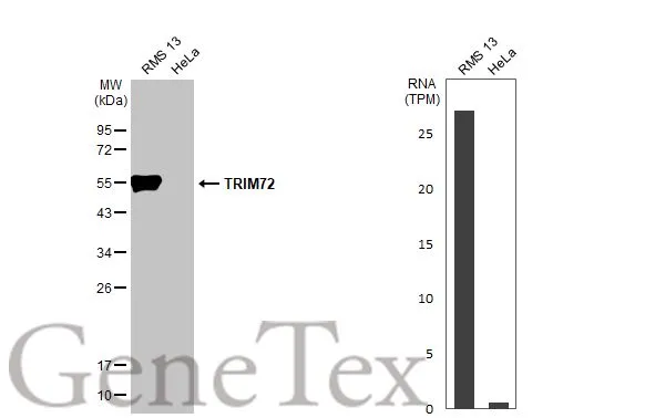 Various whole cell extracts (30 μg) were separated by 12% SDS-PAGE, and the membrane was blotted with TRIM72 antibody [HL1853] (GTX637578) diluted at 1:1000. The HRP-conjugated anti-rabbit IgG antibody (GTX213110-01) was used to detect the primary antibody. Corresponding RNA expression data for the same cell lines are based on Human Protein Atlas program.