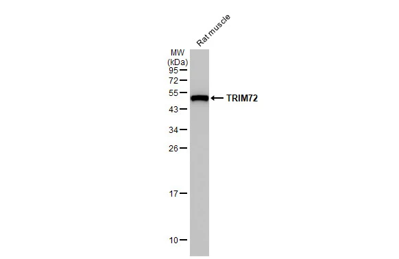 Rat tissue extract (50 μg) was separated by 12% SDS-PAGE, and the membrane was blotted with TRIM72 antibody [HL1853] (GTX637578) diluted at 1:5000. The HRP-conjugated anti-rabbit IgG antibody (GTX213110-01) was used to detect the primary antibody.