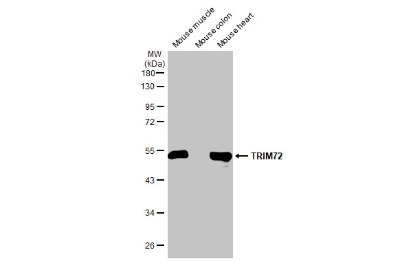 Various tissue extracts (50 μg) were separated by 10% SDS-PAGE, and the membrane was blotted with TRIM72 antibody [HL1853] (GTX637578) diluted at 1:1000. The HRP-conjugated anti-rabbit IgG antibody (GTX213110-01) was used to detect the primary antibody.