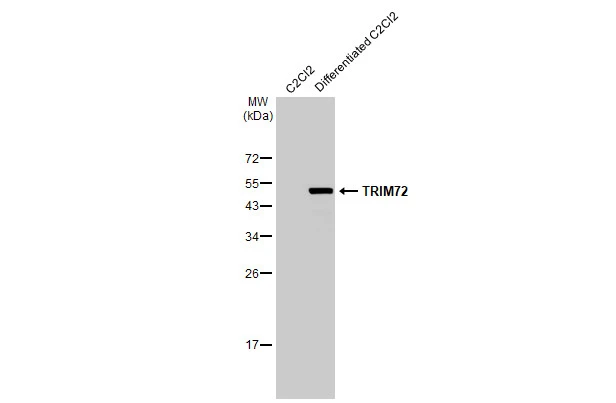 Various whole cell extracts (10 μg) were separated by 12% SDS-PAGE, and the membrane was blotted with TRIM72 antibody [HL1853] (GTX637578) diluted at 1:5000. The HRP-conjugated anti-rabbit IgG antibody (GTX213110-01) was used to detect the primary antibody.