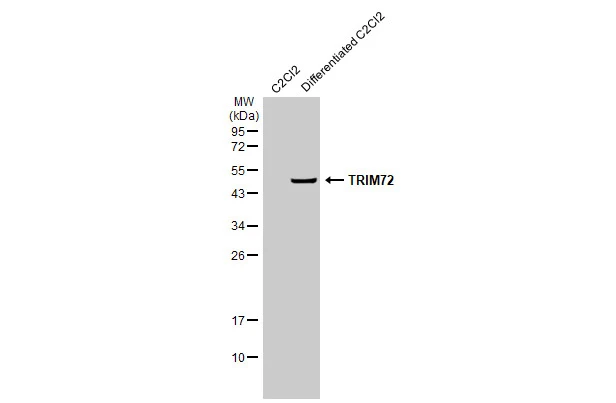C2Cl2 whole cell and differentiated extracts (50 μg) were separated by 12% SDS-PAGE, and the membrane was blotted with TRIM72 antibody [HL1855] (GTX637580) diluted at 1:5000. The HRP-conjugated anti-rabbit IgG antibody (GTX213110-01) was used to detect the primary antibody.