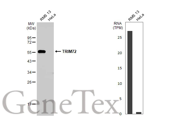 Various whole cell extracts (30 μg) were separated by 12% SDS-PAGE, and the membrane was blotted with TRIM72 antibody [HL1855] (GTX637580) diluted at 1:1000. The HRP-conjugated anti-rabbit IgG antibody (GTX213110-01) was used to detect the primary antibody. Corresponding RNA expression data for the same cell lines are based on Human Protein Atlas program.