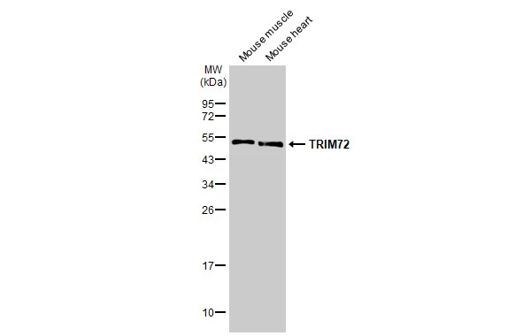 Various tissue extracts (50 μg) were separated by 12% SDS-PAGE, and the membrane was blotted with TRIM72 antibody [HL1855] (GTX637580) diluted at 1:1000. The HRP-conjugated anti-rabbit IgG antibody (GTX213110-01) was used to detect the primary antibody.