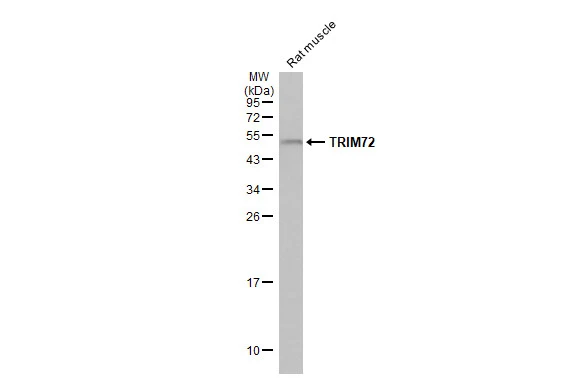 Rat tissue extract (50 μg) was separated by 12% SDS-PAGE, and the membrane was blotted with TRIM72 antibody [HL1855] (GTX637580) diluted at 1:5000. The HRP-conjugated anti-rabbit IgG antibody (GTX213110-01) was used to detect the primary antibody.