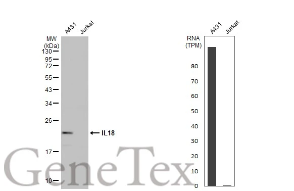 IL18 antibody [HL1859]