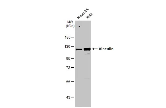 Various whole cell extracts (30 μg) were separated by 7.5% SDS-PAGE, and the membrane was blotted with Vinculin antibody [HL1873] (GTX637622) diluted at 1:1000. The HRP-conjugated anti-rabbit IgG antibody (GTX213110-01) was used to detect the primary antibody.