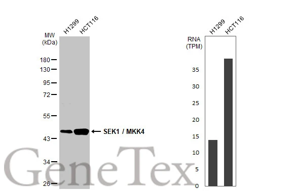Various whole cell extracts (30 μg) were separated by 10% SDS-PAGE, and the membrane was blotted with SEK1 / MKK4 antibody [HL1888] (GTX637637) diluted at 1:1000. The HRP-conjugated anti-rabbit IgG antibody (GTX213110-01) was used to detect the primary antibody.Corresponding RNA expression data for the same cell lines are based on Human Protein Atlas program.