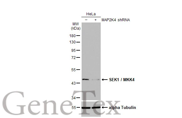 Untransfected (–) and transfected (+) HeLa whole cell extract (30 μg) were separated by 10% SDS-PAGE, and the membrane was blotted with SEK1 / MKK4 antibody [HL1888] (GTX637637) diluted at 1:1000. The HRP-conjugated anti-rabbit IgG antibody (GTX213110-01) was used to detect the primary antibody.