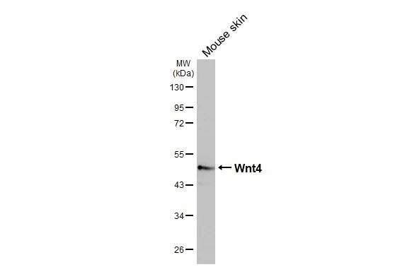 Mouse tissue extract (50 μg) was separated by 10% SDS-PAGE, and the membrane was blotted with Wnt4 antibody [HL1889] (GTX637638) diluted at 1:2000. The HRP-conjugated anti-rabbit IgG antibody (GTX213110-01) was used to detect the primary antibody.