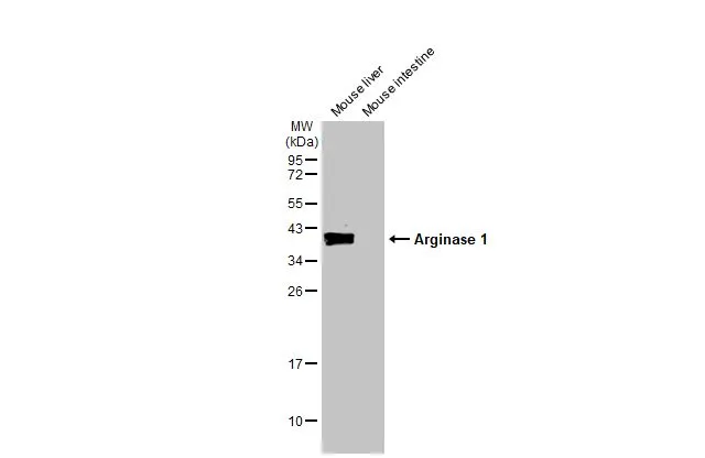 Various tissue extracts (50 μg) were separated by 12% SDS-PAGE, and the membrane was blotted with Arginase 1 antibody [HL1891] (GTX637640) diluted at 1:500. The HRP-conjugated anti-rabbit IgG antibody (GTX213110-01) was used to detect the primary antibody.
