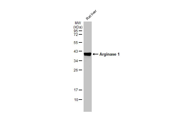 Rat tissue extract (5 μg) was separated by 12% SDS-PAGE, and the membrane was blotted with Arginase 1 antibody [HL1891] (GTX637640) diluted at 1:40000. The HRP-conjugated anti-rabbit IgG antibody (GTX213110-01) was used to detect the primary antibody.