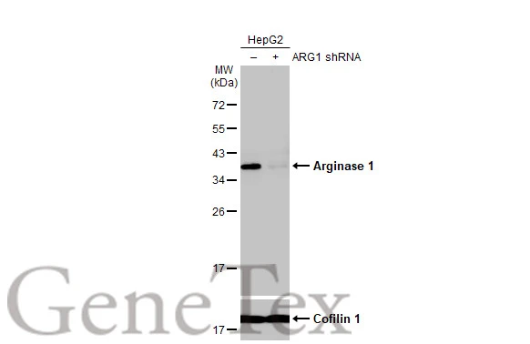 Non-transfected (–) and transfected (+) HepG2 whole cell extracts (30 μg) were separated by 12% SDS-PAGE, and the membrane was blotted with Arginase 1 antibody [HL1891] (GTX637640) diluted at 1:500. The HRP-conjugated anti-rabbit IgG antibody (GTX213110-01) was used to detect the primary antibody, and the signal was developed with Trident ECL plus-Enhanced.