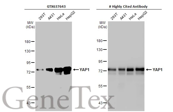 Various whole cell extracts (30 μg) were separated by 7.5% SDS-PAGE, and the membranes were blotted with YAP1 antibody [HL1894] (GTX637643) diluted at 1:1000 and competitor's antibody (#Highly competitor antibody) diluted at 1:1000. The HRP-conjugated anti-rabbit IgG antibody (GTX213110-01) was used to detect the primary antibody. *The competitor is not affiliated with GeneTex and does not endorse this product.