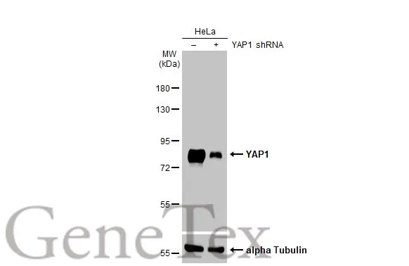 Non-transfected (–) and transfected (+) HeLa whole cell extracts (30 μg) were separated by 7.5% SDS-PAGE, and the membrane was blotted with YAP1 antibody [HL1894] (GTX637643) diluted at 1:4000. The HRP-conjugated anti-rabbit IgG antibody (GTX213110-01) was used to detect the primary antibody, and the signal was developed with Trident ECL plus-Enhanced.