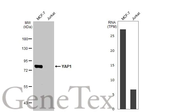 Various whole cell extracts (30 μg) were separated by 7.5% SDS-PAGE, and the membrane was blotted with YAP1 antibody [HL1894] (GTX637643) diluted at 1:4000. The HRP-conjugated anti-rabbit IgG antibody (GTX213110-01) was used to detect the primary antibody, and the signal was developed with Trident ECL plus-Enhanced. Corresponding RNA expression data for the same cell lines are based on Human Protein Atlas program.