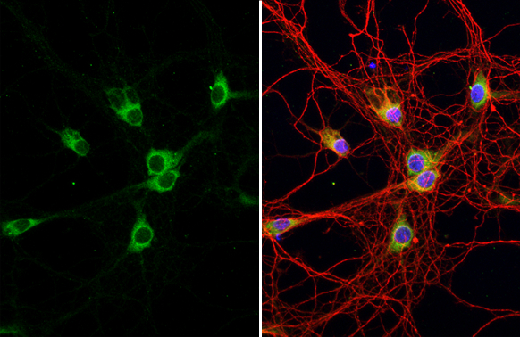 ATXN2 antibody [HL1902] detects ATXN2 protein at cytoplasm by immunofluorescent analysis. Sample: DIV9 rat E18 primary hippocampal neuron cells were fixed in 4% paraformaldehyde at RT for 15 min. Green: ATXN2 stained by ATXN2 antibody [HL1902] (GTX637651) diluted at 1:250. Red: Tau, an axon marker, stained by Tau antibody [GT287] (GTX634809) diluted at 1:500. Blue: Fluoroshield with DAPI (GTX30920).