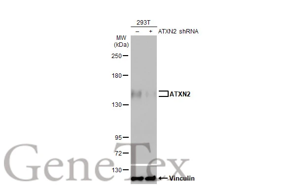 Non-transfected (–) and transfected (+) transfected 293T (30 μg) were separated by 5% SDS-PAGE, and the membrane was blotted with ATXN2 antibody [HL1903] (GTX637652) diluted at 1:1000. The HRP-conjugated anti-rabbit IgG antibody (GTX213110-01) was used to detect the primary antibody.