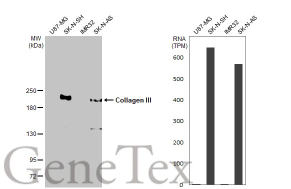 Collagen III antibody [HL1906]