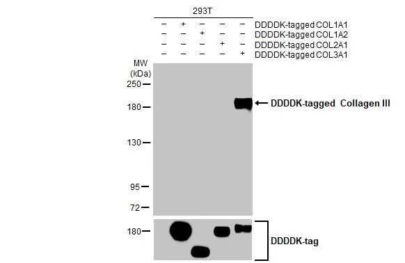 Collagen III antibody [HL1906]