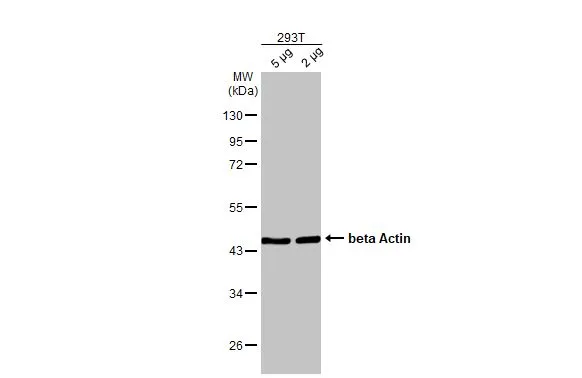 beta Actin antibody [HL1926]