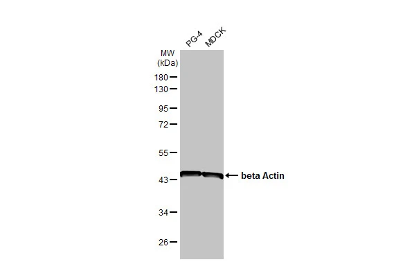 Various whole cell extracts (30 μg) were separated by 10% SDS-PAGE, and the membrane was blotted with beta Actin antibody [HL1926] (GTX637675) diluted at 1:10000. The HRP-conjugated anti-rabbit IgG antibody (GTX213110-01) was used to detect the primary antibody.