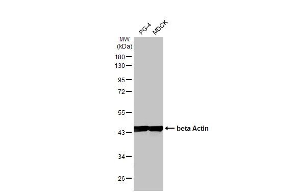 Various whole cell extracts (30 μg) were separated by 10% SDS-PAGE, and the membrane was blotted with beta Actin antibody [HL1927] (GTX637676) diluted at 1:10000. The HRP-conjugated anti-rabbit IgG antibody (GTX213110-01) was used to detect the primary antibody.