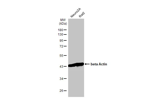 Various whole cell extracts (30 μg) were separated by 10% SDS-PAGE, and the membrane was blotted with beta Actin antibody [HL1927] (GTX637676) diluted at 1:50000. The HRP-conjugated anti-rabbit IgG antibody (GTX213110-01) was used to detect the primary antibody.