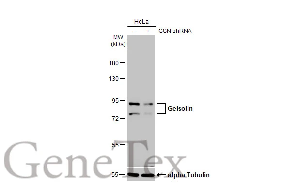 Non-transfected (–) and transfected (+) HeLa whole cell extract (30 μg) were separated by 7.5% SDS-PAGE, and the membrane was blotted with Gelsolin antibody [HL1930] (GTX637767) diluted at 1:1000. The HRP-conjugated anti-rabbit IgG antibody (GTX213110-01) was used to detect the primary antibody.