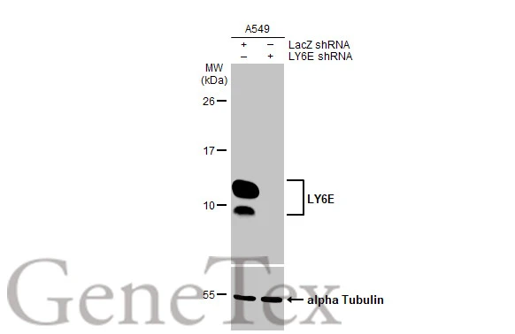 Non-transfected (–) and transfected (+) A549 whole cell extract (30 μg) were separated by 15% SDS-PAGE, and the membrane was blotted with LY6E antibody [HL1933] (GTX637770) diluted at 1:1000. The HRP-conjugated anti-rabbit IgG antibody (GTX213110-01) was used to detect the primary antibody.