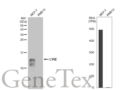 LY6E antibody [HL1933]