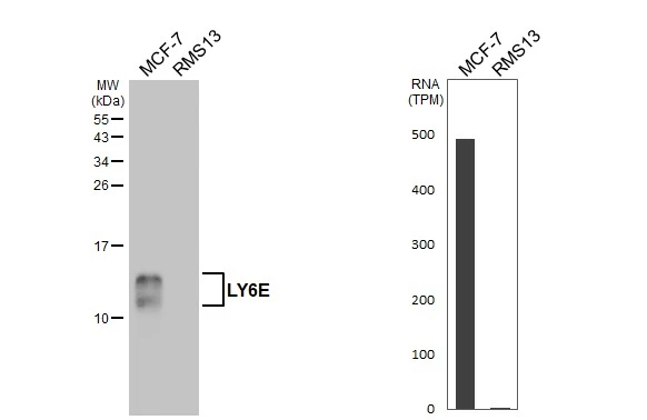 Various whole cell extracts (30 μg) were separated by 15% SDS-PAGE, and the membrane was blotted with LY6E antibody [HL1933] (GTX637770) diluted at 1:1000. The HRP-conjugated anti-rabbit IgG antibody (GTX213110-01) was used to detect the primary antibody. Corresponding RNA expression data for the same cell lines are based on Human Protein Atlas program.