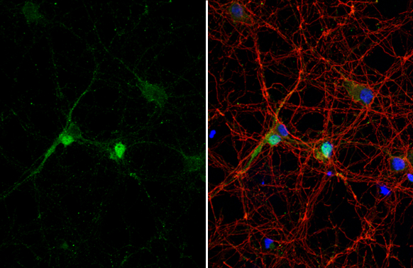 DLX2 antibody [HL1942] detects DLX2 protein at nucleus by immunofluorescent analysis. Sample: DIV9 rat E18 primary cortical neuron and glia cells were fixed in 4% paraformaldehyde at RT for 15 min. Green: DLX2 stained by DLX2 antibody [HL1942] (GTX637779) diluted at 1:250. Red: Tau, an axon marker, stained by Tau antibody [GT287] (GTX634809) diluted at 1:500. Blue: Fluoroshield with DAPI (GTX30920).