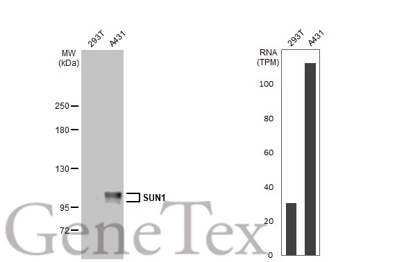 SUN1 antibody [HL1947]