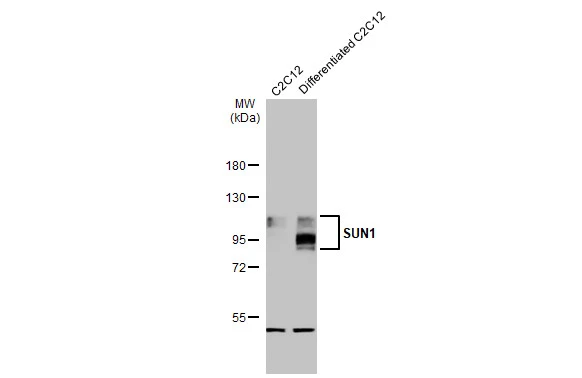 Various whole cell extracts (30 μg) were separated by 7.5% SDS-PAGE, and the membrane was blotted with SUN1 antibody [HL1947] (GTX637784) diluted at 1:1000. The HRP-conjugated anti-rabbit IgG antibody (GTX213110-01) was used to detect the primary antibody.